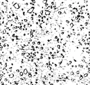 Cementite globules in martensite, in hardened steel