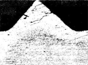 Case-hardened screw, cracked martensitic case (white), martensite and fer-rite core